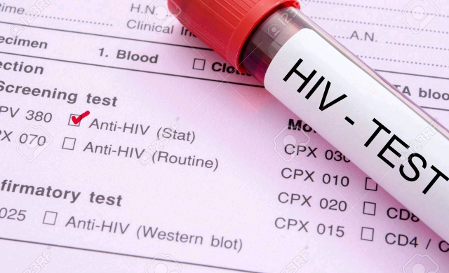 HIV test.jpg